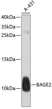 Western blot analysis of extracts of A-431 cells using BAGE2 Polyclonal Antibody at dilution of 1:1000.