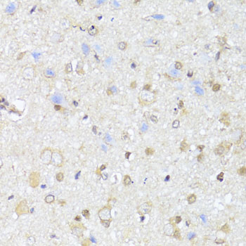 Immunohistochemistry of paraffin-embedded Rat brain using EGLN1/EGLN2 Polyclonal Antibody at dilution of  1:100 (40x lens).