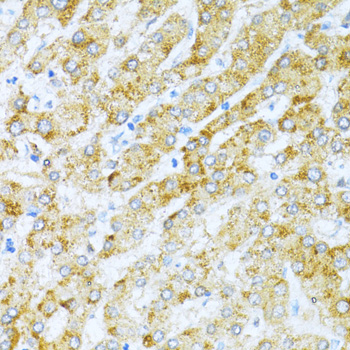 Immunohistochemistry of paraffin-embedded Human liver using KLHL42 Polyclonal Antibody at dilution of  1:100 (40x lens).