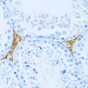 Immunohistochemistry of paraffin-embedded Mouse testis leydig using KLHL42 Polyclonal Antibody at dilution of  1:100 (40x lens).