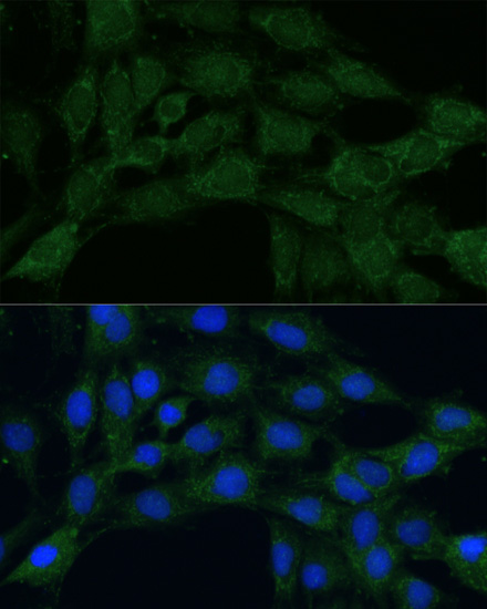 Immunofluorescence analysis of C6 cells using MTHFD2 Polyclonal Antibody at dilution of  1:100. Blue: DAPI for nuclear staining.