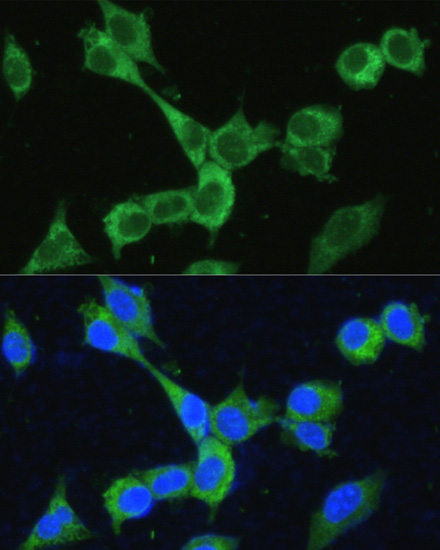 Immunofluorescence analysis of NIH-3T3 cells using MTHFD2 Polyclonal Antibody at dilution of  1:100. Blue: DAPI for nuclear staining.