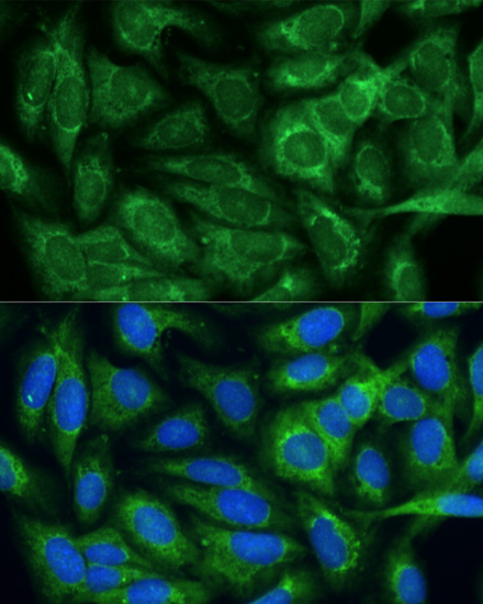 Immunofluorescence analysis of U-2 OS cells using MTHFD2 Polyclonal Antibody at dilution of  1:100. Blue: DAPI for nuclear staining.