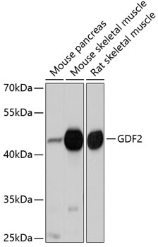 Western blot analysis of extracts of various cell lines using GDF2 Polyclonal Antibody at dilution of 1:1000.
