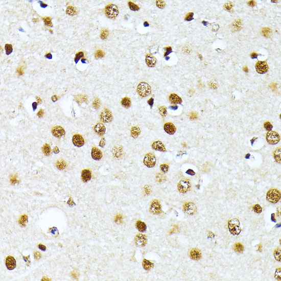 Immunohistochemistry of paraffin-embedded Mouse brain using PRMT1 Polyclonal Antibody at dilution of  1:100 (40x lens).