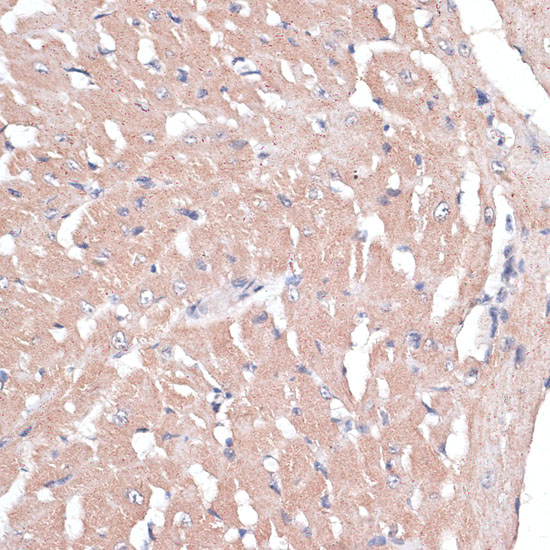 Immunohistochemistry of paraffin-embedded Mouse heart using COL11A1 Polyclonal Antibody at dilution of  1:100 (40x lens).