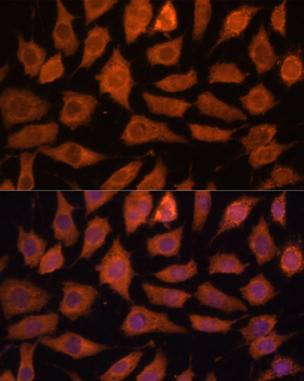 Immunofluorescence analysis of L929 cells using LGMN Polyclonal Antibody at dilution of  1:100 (40x lens). Blue: DAPI for nuclear staining.