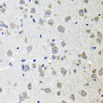 Immunohistochemistry of paraffin-embedded Mouse brain using ALPL Polyclonal Antibody at dilution of  1:100 (40x lens).