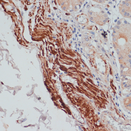 Immunohistochemistry of paraffin-embedded Human stomach using DES Polyclonal Antibody at dilution of  1:100 (40x lens).
