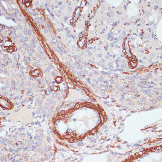 Immunohistochemistry of paraffin-embedded Rat ovary using DES Polyclonal Antibody at dilution of  1:100 (40x lens).