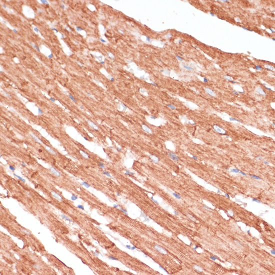 Immunohistochemistry of paraffin-embedded Rat heart using DES Polyclonal Antibody at dilution of  1:100 (40x lens).