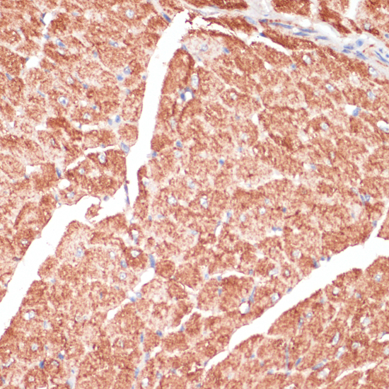 Immunohistochemistry of paraffin-embedded Mouse heart using DES Polyclonal Antibody at dilution of  1:100 (40x lens).