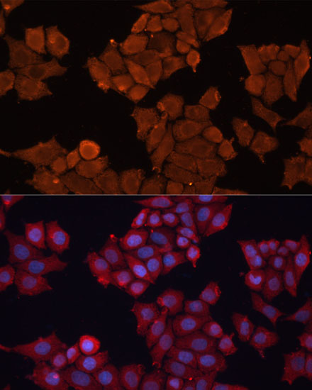 Immunofluorescence analysis of HeLa cells using HSD17B1 Polyclonal Antibody at dilution of  1:100 (40x lens). Blue: DAPI for nuclear staining.