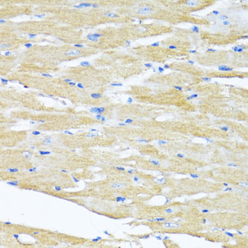 Immunohistochemistry of paraffin-embedded Mouse heart using HSD17B1 Polyclonal Antibody at dilution of  1:100 (40x lens).