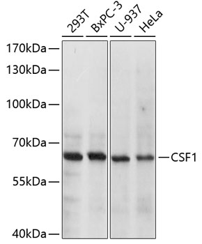 Western blot analysis of extracts of various cell lines using CSF1 Polyclonal Antibody at dilution of 1:1000.