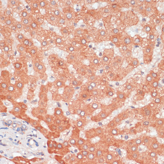Immunohistochemistry of paraffin-embedded Human liver using ATG5 Polyclonal Antibody at dilution of  1:100 (40x lens).