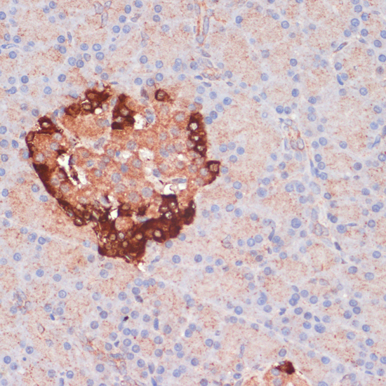Immunohistochemistry of paraffin-embedded Rat pancreas using ATG5 Polyclonal Antibody at dilution of  1:100 (40x lens).