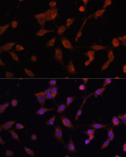 Immunofluorescence analysis of NIH/3T3 cells using LAMP1 Polyclonal Antibody at dilution of  1:100. Blue: DAPI for nuclear staining.