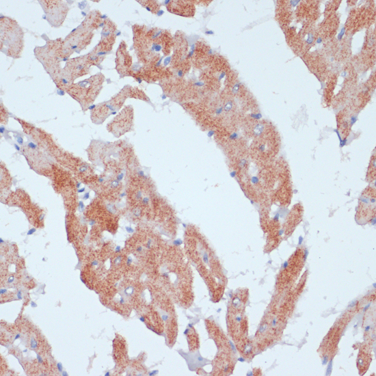 Immunohistochemistry of paraffin-embedded Rat heart using ACSL3 Polyclonal Antibody at dilution of  1:100 (40x lens).