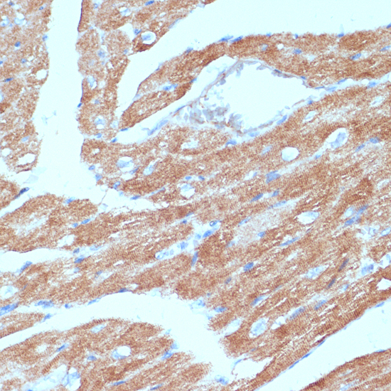 Immunohistochemistry of paraffin-embedded Mouse heart using ACSL3 Polyclonal Antibody at dilution of  1:100 (40x lens).