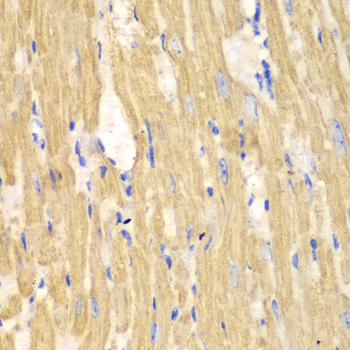 Immunohistochemistry of paraffin-embedded Mouse heart using CAPN1 Polyclonal Antibody at dilution of  1:100 (40x lens).