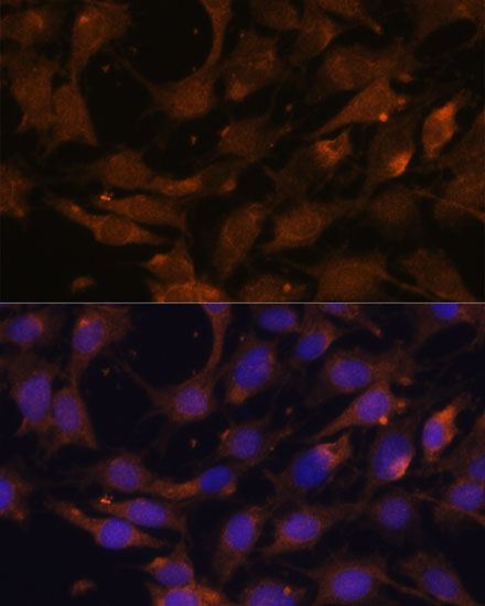 Immunofluorescence analysis of C6 cells using KRAS Polyclonal Antibody at dilution of  1:100. Blue: DAPI for nuclear staining.