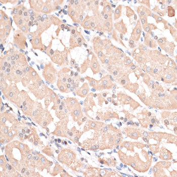 Immunohistochemistry of paraffin-embedded Human stomach using ABCC5 Polyclonal Antibody at dilution of  1:100 (40x lens).