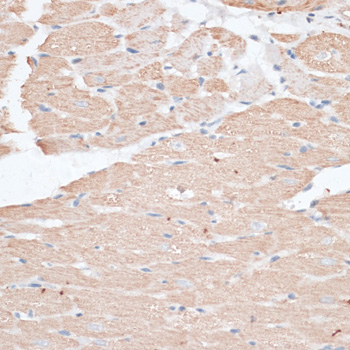 Immunohistochemistry of paraffin-embedded Rat heart using ABCC5 Polyclonal Antibody at dilution of  1:100 (40x lens).