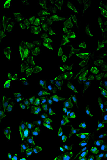 Immunofluorescence analysis of HeLa cells using TPM3 Polyclonal Antibody