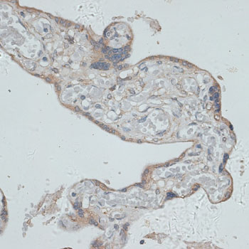 Immunohistochemistry of paraffin-embedded Human placenta using GMPR Polyclonal Antibody at dilution of  1:100 (40x lens).