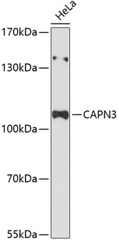 Western blot analysis of extracts of HeLa cells using CAPN3 Polyclonal Antibody at dilution of 1:3000.