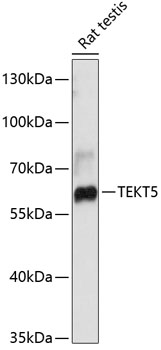 Western blot analysis of extracts of Rat testis using TEKT5 Polyclonal Antibody at dilution of 1:3000.