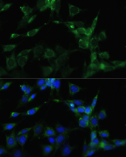 Immunofluorescence analysis of NIH-3T3 cells using HSP90AA1 Polyclonal Antibody at dilution of  1:100. Blue: DAPI for nuclear staining.