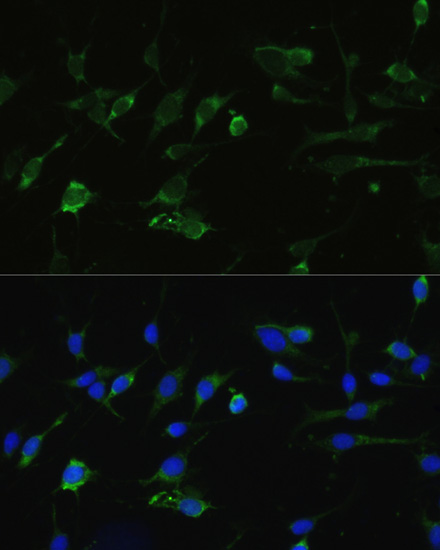 Immunofluorescence analysis of C6 cells using HSP90AA1 Polyclonal Antibody at dilution of  1:100. Blue: DAPI for nuclear staining.