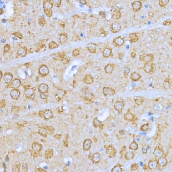 Immunohistochemistry of paraffin-embedded Rat brain using HSP90AA1 Polyclonal Antibody at dilution of  1:200 (40x lens).