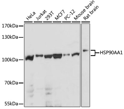 Western blot analysis of extracts of various cell lines using HSP90AA1 Polyclonal Antibody at dilution of 1:1000.
