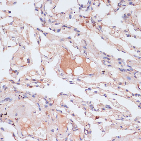 Immunohistochemistry of paraffin-embedded Human lung using IFNG Polyclonal Antibody at dilution of  1:100 (40x lens).