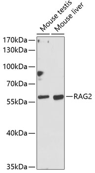 Western blot analysis of extracts of various cell lines using RAG2 Polyclonal Antibody at dilution of 1:1000.