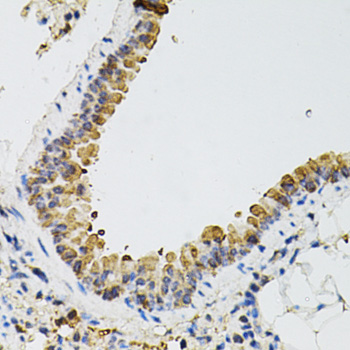 Immunohistochemistry of paraffin-embedded Mouse lung using ARHGEF2 Polyclonal Antibody at dilution of  1:100 (40x lens).