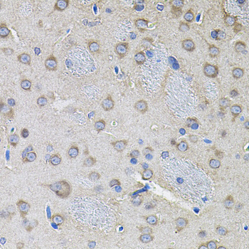 Immunohistochemistry of paraffin-embedded Rat brain using IKBKG Polyclonal Antibody