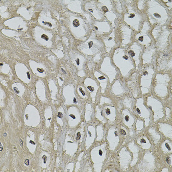 Immunohistochemistry of paraffin-embedded Human esophagus using IL33 Polyclonal Antibody