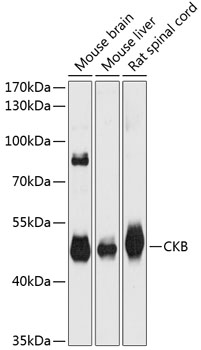 Western blot analysis of extracts of various cell lines using CKB Polyclonal Antibody at dilution of 1:3000.