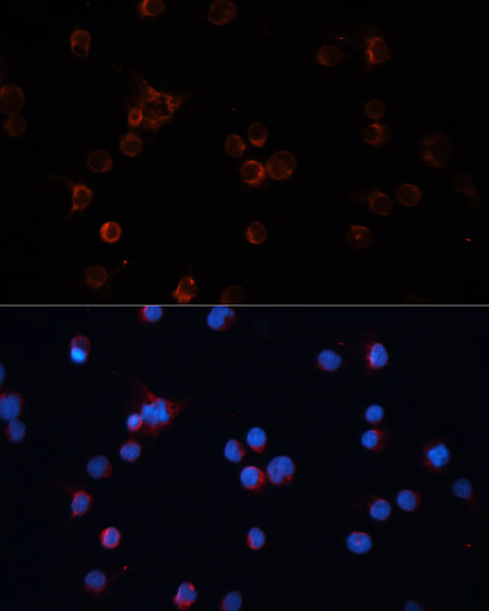 Immunofluorescence analysis of Jurkat cells using TH Polyclonal Antibody at dilution of  1:100 (40x lens). Blue: DAPI for nuclear staining.