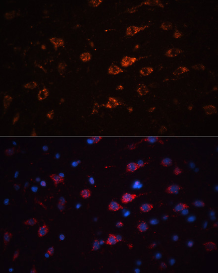 Immunofluorescence analysis of Rat brain using TH Polyclonal Antibody at dilution of  1:100. Blue: DAPI for nuclear staining.