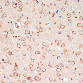 Immunohistochemistry of paraffin-embedded Mouse brain using TH Polyclonal Antibody at dilution of  1:200 (40x lens).