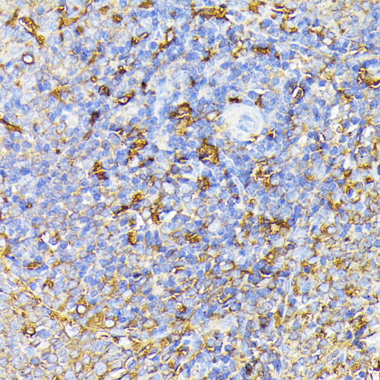 Immunohistochemistry of paraffin-embedded Rat spleen using VEGF Receptor 1 Polyclonal Antibody at dilution of  1:100 (40x lens).