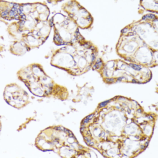 Immunohistochemistry of paraffin-embedded Human placenta using VEGF Receptor 1 Polyclonal Antibody at dilution of  1:100 (40x lens).