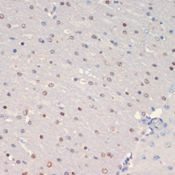 Immunohistochemistry of paraffin-embedded Mouse brain using OLIG2 Polyclonal Antibody at dilution of  1:200 (40x lens).