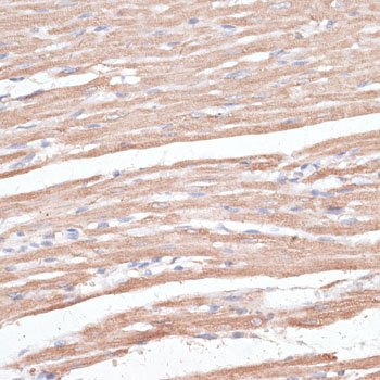 Immunohistochemistry of paraffin-embedded Rat heart using KCNK1 Polyclonal Antibody at dilution of  1:100 (40x lens).