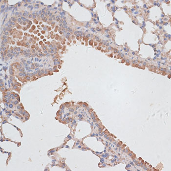 Immunohistochemistry of paraffin-embedded Mouse lung using KCNK1 Polyclonal Antibody at dilution of  1:100 (40x lens).